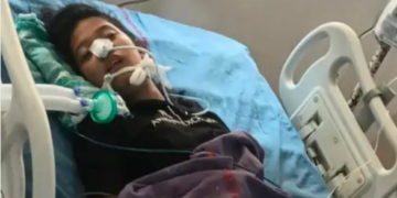 हिसार: हॉस्टल में छात्रा को सांप ने डसा, अग्रोहा मेडिकल कॉलेज में इलाज जारी ,